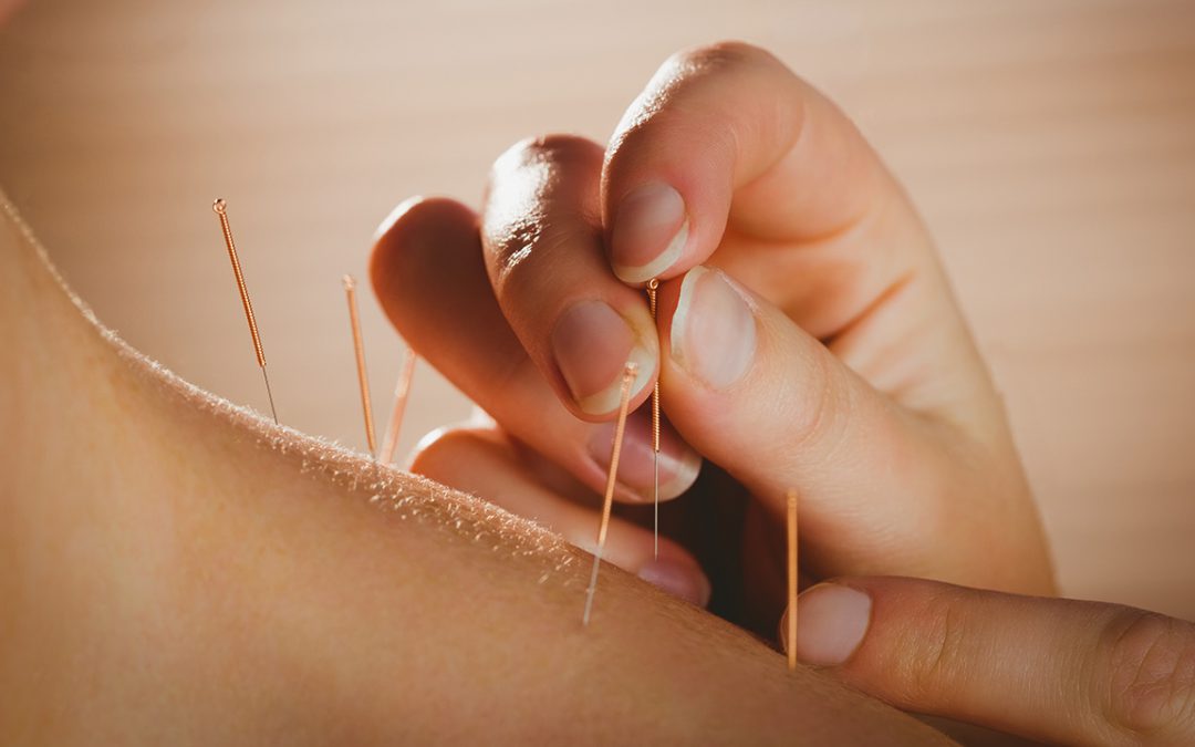 ACUPUNCTURE AND CHINESE MEDICINE